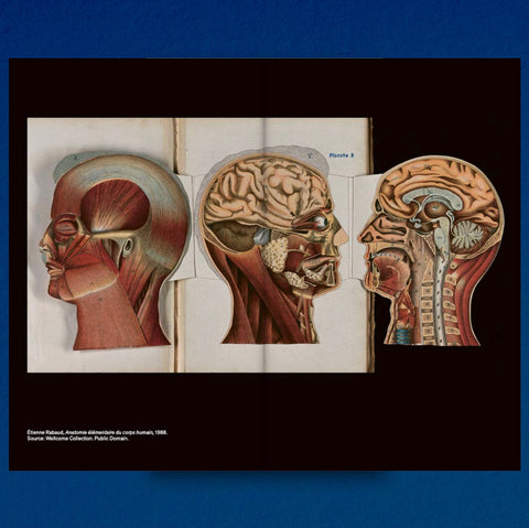 Decapitated Economies